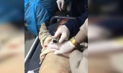 Sağlık ekipleri Filistinli çocuğu hayata tutundurmaya çalıştı!