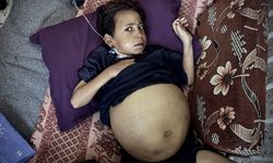 Dalak ve karaciğer büyümesi hastası Gazzeli çocuk, yaşam mücadelesi veriyor!