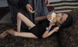 Gazzeli Muhammed hayata tutunmaya çalışıyor!