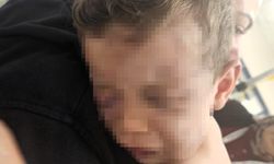 Aren bebeği hastanelik eden caniler gözaltına alındı
