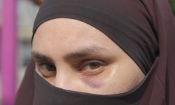 Çocuklarının gözü önünde darbedildi