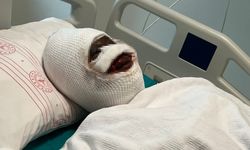 Eski eşten vahşet: O kadın yaşadıklarını anlattı!