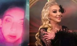 Güllü'nün kızı "Annem beni dövdü" deyip kanlar içinde video paylaşmış