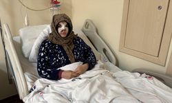 Eşi tarafından darbedilen kadın saldırı anını anlattı!