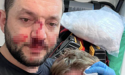 Pide kuyruğunda vahşet: Baba ve kızına saldırdı