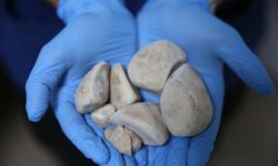 İdrar kanalı ve mesanesinden yarım kilo taş çıkarıldı!