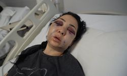 Anneyi bu hale getiren 3 kişiden 1'i tutuklandı!