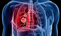 Tüberküloz vaka sayısı 9 binlere geriledi!