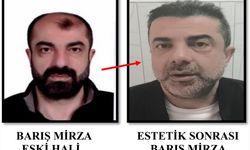 Ameliyatla yüzünü değiştirmesine rağmen yakalandı!