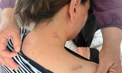 17 bıçak darbesi aldı, ölü numarasıyla kurtuldu!