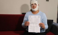 Güzelleşmek uğruna gittiği merkezde yüzü yandı!