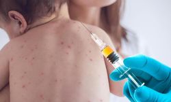 100'den fazla çocuk kızamıktan öldü!