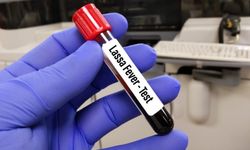 Lassa ateşi nedeniyle 167 kişi öldü!