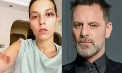 Ozan Güven'den özür açıklaması