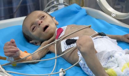 Gazze'de bebekler açlıktan ölümün pençesinde!