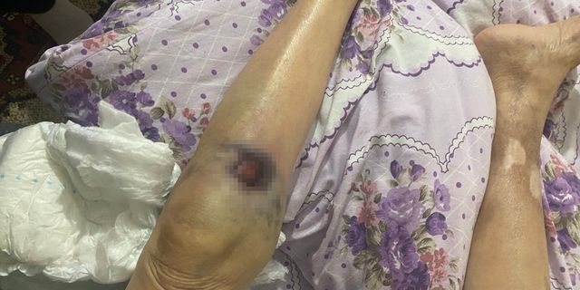 Ankara’da bakıcı dehşeti: 91 yaşındaki kadın komada!