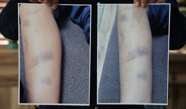 Diyarbakır'da özel okulda şiddet iddiası