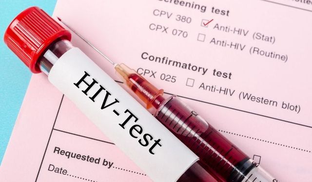 DSÖ'den korkutan rakam: 1,3 milyon kişi AIDS'e yakalandı!