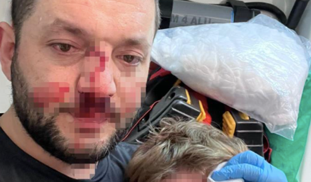 Pide kuyruğunda vahşet: Baba ve kızına saldırdı