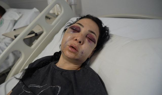 Anneyi bu hale getiren 3 kişiden 1'i tutuklandı!