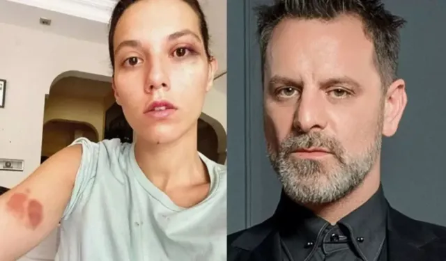 Ozan Güven'den özür açıklaması