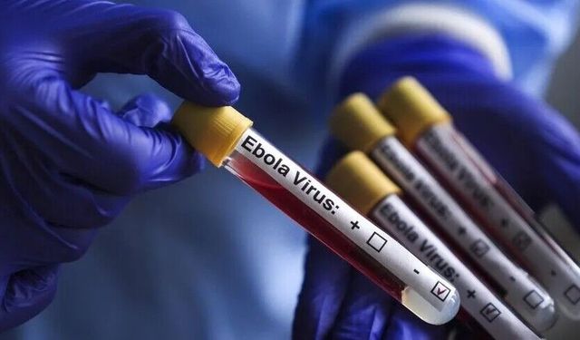 Ebola alarmı: ABD'den Kongo çıkışlı yolculara kısıtlama