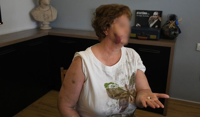 Ev kavgası kanlı bitti: Anne ve iki çocuğu bıçaklandı!