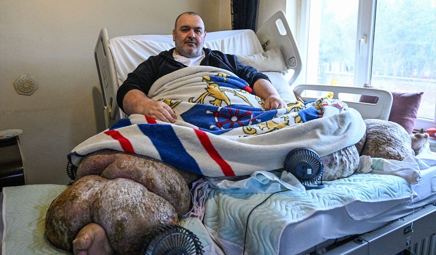 300 kiloluk hasta, özel ekiple evinden çıkarıldı!