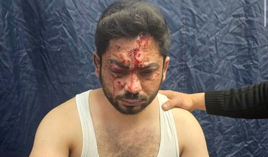 Suriye’de mayın patladı: Biri muhabir 3 kişi yaralandı!