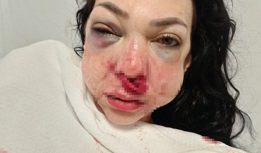 Oğlunun gözü önünde anneyi komalık ettiler!