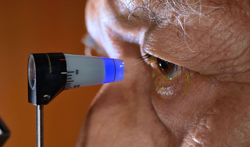Sağlık Bakanlığı: 750 bin kişiye glokom tanısı konuldu!