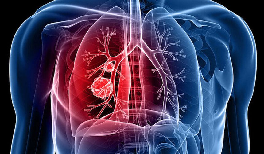 Tüberküloz vaka sayısı 9 binlere geriledi!