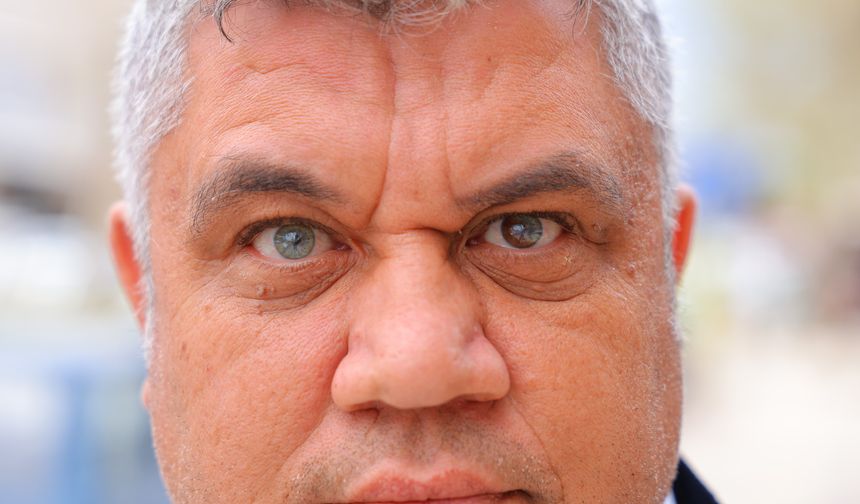 Sol gözü kahverengi ve yeşil, sağ gözü mavi