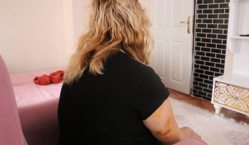 Yine koca dehşeti: 30 yerinden bıçakladı!