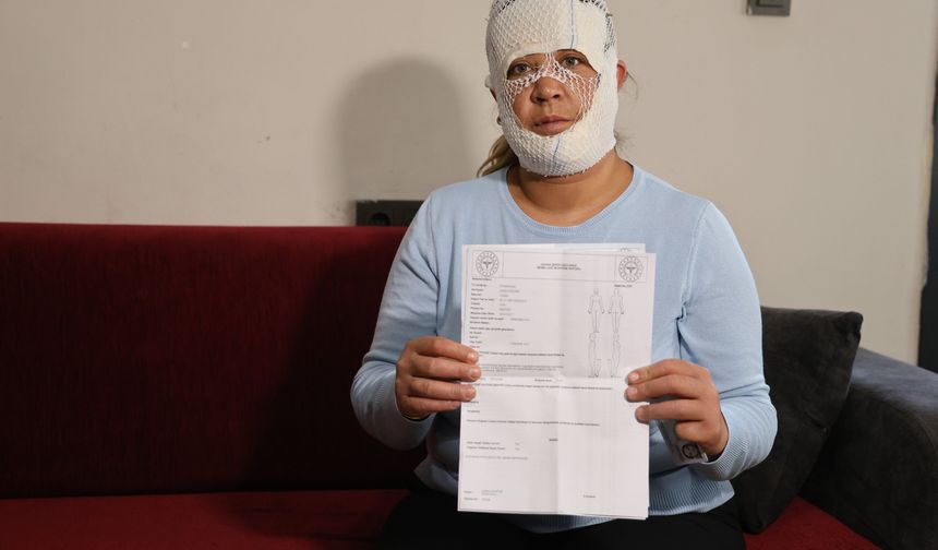 Güzelleşmek uğruna gittiği merkezde yüzü yandı!