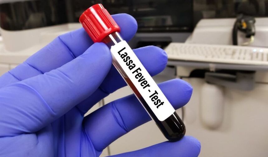 Lassa ateşi nedeniyle 167 kişi öldü!