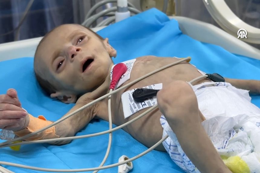 Gazze'de bebekler açlıktan ölümün pençesinde!
