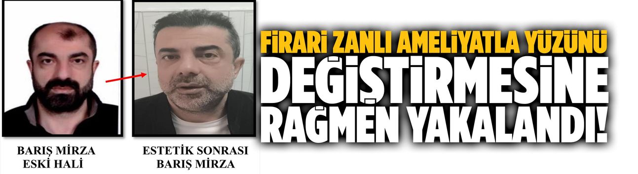 Ameliyatla yüzünü değiştirmesine rağmen yakalandı!