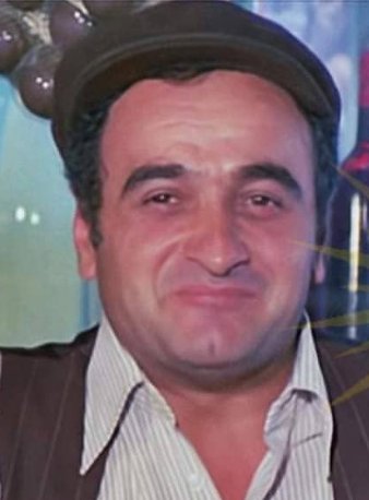 L Alpay Izer 1O43425