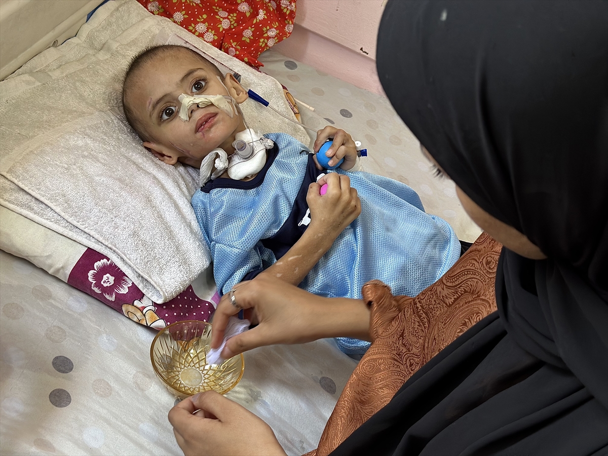 Aa 20250627 38400293 38400281 Israil Saldirisinda Tum Ailesini Kaybeden Gazzeli Cocuk Yasam Mucadelesi Veriyor (1)