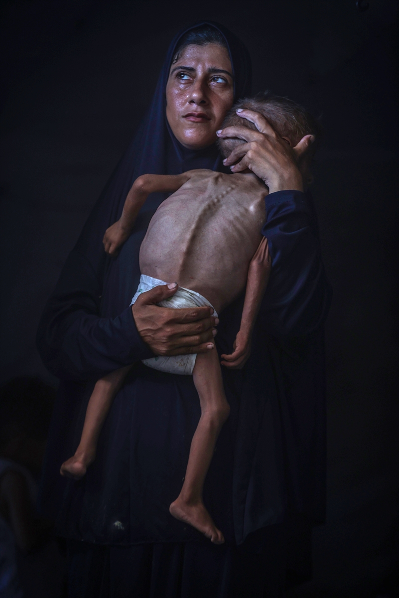 A A 20250725 38655517 38655508 G A Z Z E D E Y E T E R S I Z B E S L E N M E S O R U N U Y A S A Y A N C O C U K O L U M T E H L I K E S I Y L E K A R S I K A R S I Y A