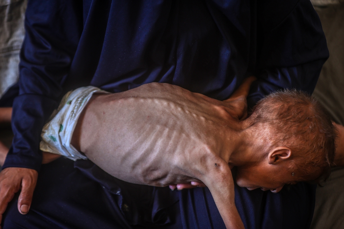 A A 20250725 38655517 38655511 G A Z Z E D E Y E T E R S I Z B E S L E N M E S O R U N U Y A S A Y A N C O C U K O L U M T E H L I K E S I Y L E K A R S I K A R S I Y A