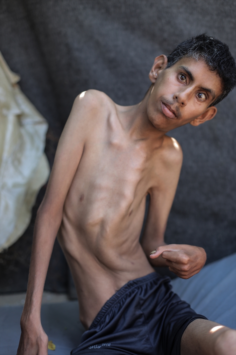 A A 20250728 38683159 38683143 G A Z Z E D E G I D A Y E T E R S I Z L I G I G E N C L E R I D E E T K I L I Y O R