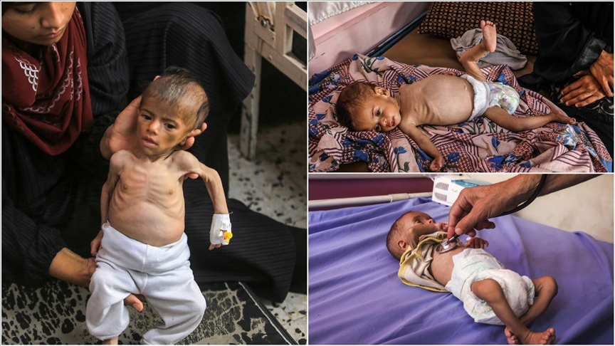 Thumbs B C 9B7B224Aff3Ca3F95331A97B6173Db06