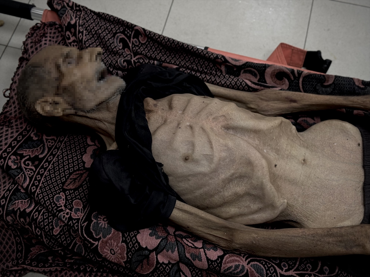 A A 20250811 38796868 38796853 G A Z Z E D E Y E T E R S I Z B E S L E N M E N E D E N I Y L E 86 Y A S I N D A K I F I L I S T I N L I H A Y A T I N I K A Y B E T T I