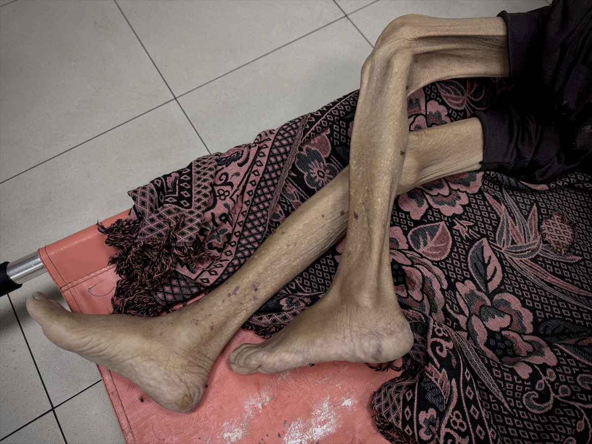 A A 20250811 38796868 38796864 G A Z Z E D E Y E T E R S I Z B E S L E N M E N E D E N I Y L E 86 Y A S I N D A K I F I L I S T I N L I H A Y A T I N I K A Y B E T T I