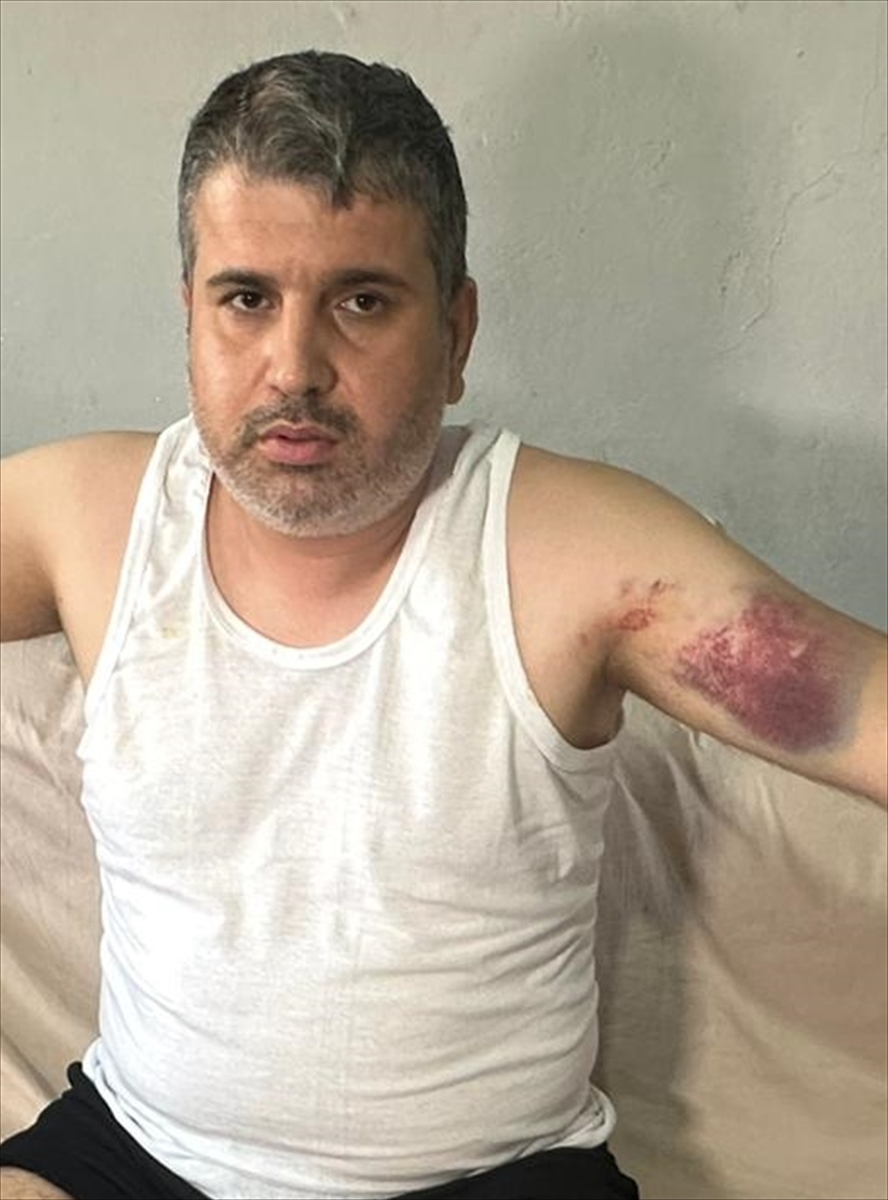 A A 20250811 38796885 38796883 A D A N A D A D A Y I S I T A R A F I N D A N B E Y Z B O L S O P A S I Y L A D A R B E D I L E N K I S I Y A R A L A N D I