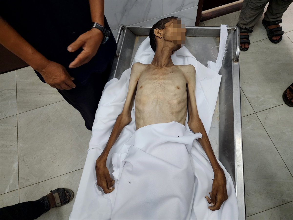 A A 20250812 38808851 38808849 G A Z Z E D E Y E T E R S I Z B E S L E N M E N E D E N I Y L E 30 Y A S I N D A K I F I L I S T I N L I H A Y A T I N I K A Y B E T T I