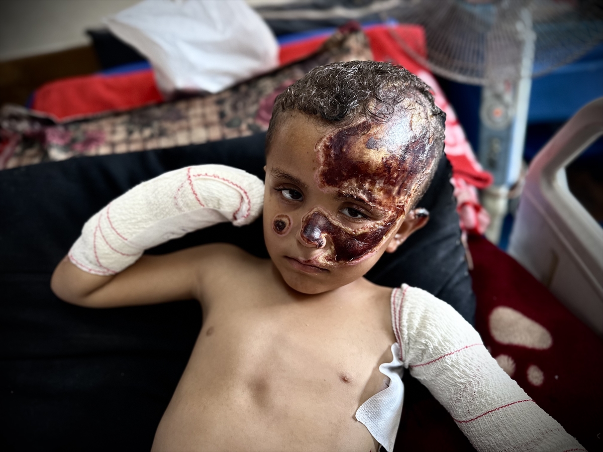 A A 20250814 38824796 38824780 I S R A I L S A L D I R I S I N D A O K S U Z K A L A N G A Z Z E L I C O C U K A L D I G I Y A R A L A R L A Y A S A M M U C A D E L E S I V E R I Y O R