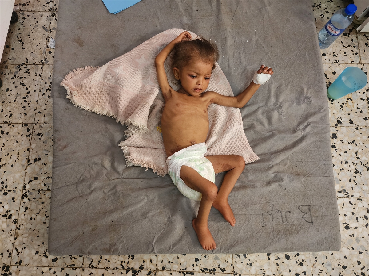 A A 20250908 39053176 39053150 G A Z Z E D E C O C U K L A R D A Y E T E R S I Z B E S L E N M E V A K A L A R I N D A A R T I S Y A S A N I Y O R